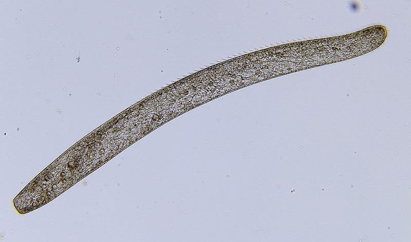Spirostomum