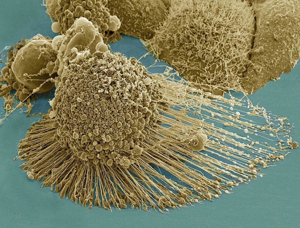 HeLa IV