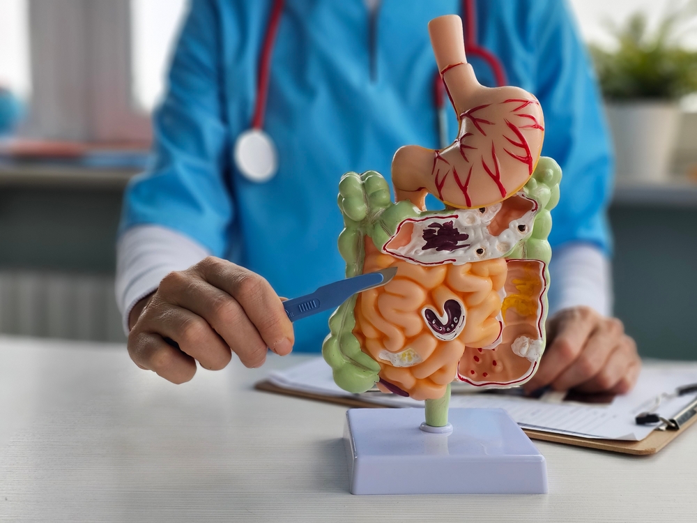 Surgeon,With,Scalpel,On,Digestive,System,Model.,Surgical,Interventions,On