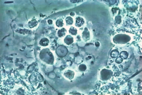 Entamoeba Entamoeba