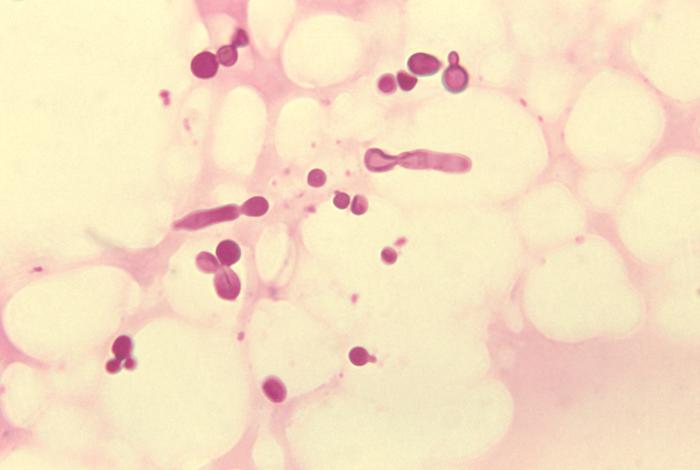 Malassezia Malassezia