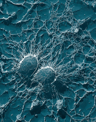 Staphylococcus aureus, 50,000x, USDA, ARS, EMU Staphylococcus aureus, 50,000x, USDA, ARS, EMU