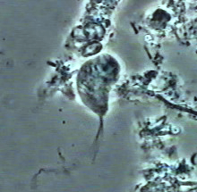 Trichomonas tenax Trichomonas tenax