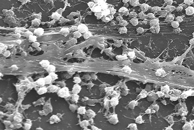 biofilm biofilm