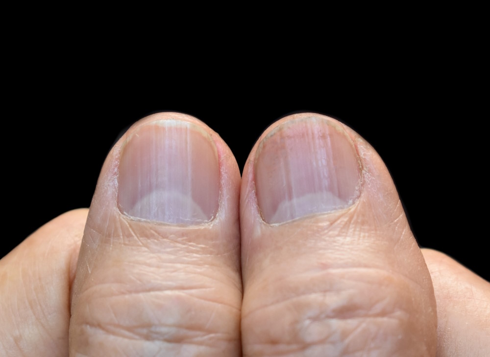 Lunula